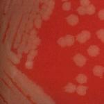 Sibīrijas mēra bakterioloģiskās diagnostikas bioloģisko produktu izraisītājs